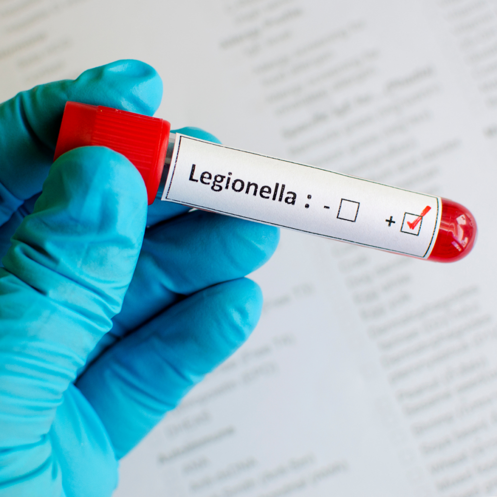 Legionella Testing