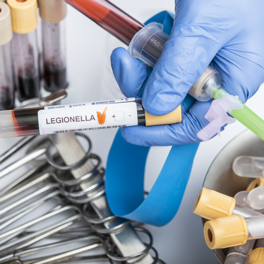 Legionella Testing